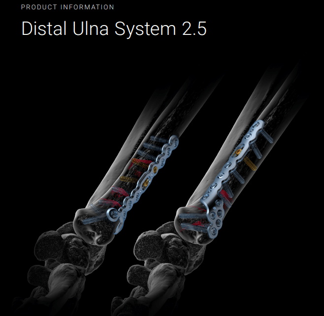 Distal-Ulna-System-2.5