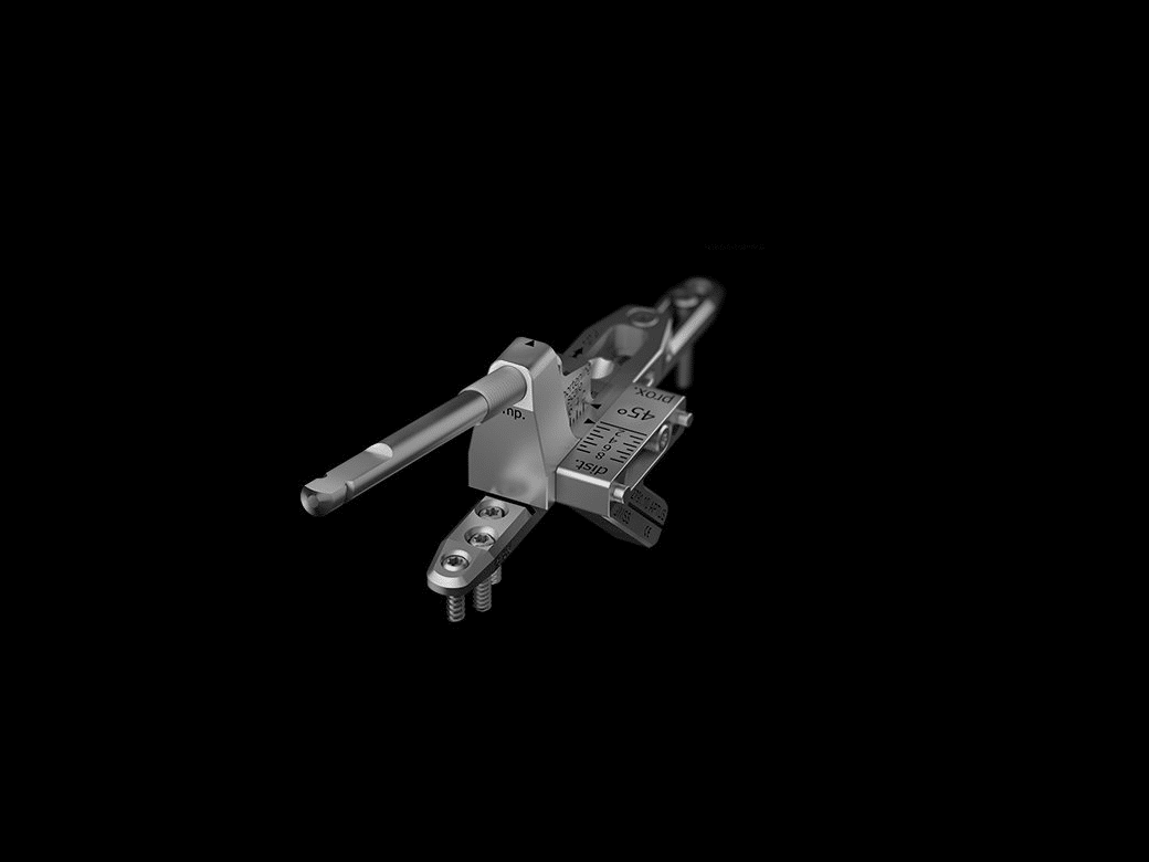 Ulna shortening system