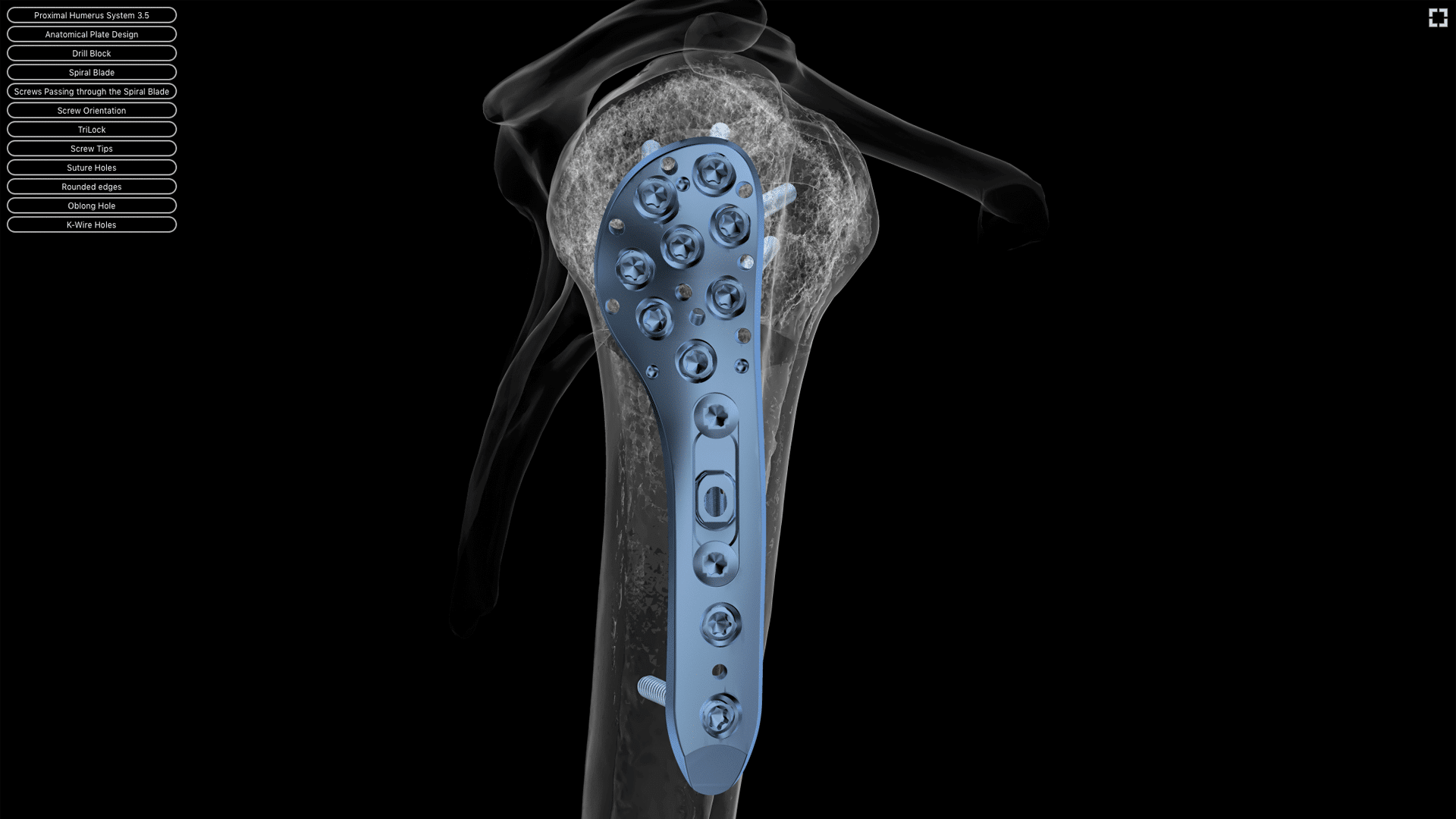 Proximal Humerus System 3.5